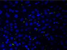 COL2A1 / Collagen II Alpha 1 Antibody - 1:200 staining human liver cells by IF/ICC. cells were formaldehyde fixed, permeabilized by Triton X-100 and blocked 5% BSA for 30 min at room temperature. The sample was incubated with the primary antibody (1:200 in BSA) for 1 hour. An Alexa Fluor 488®-conjugated Goat anti-rabbit antibody was used as the secondary.