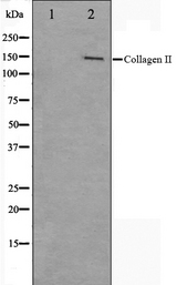 COL2A1 / Collagen II Alpha 1 Antibody - Western blot analysis on COLO205 cell lysates using Collagen II antibody. The lane on the left is treated with the antigen-specific peptide.