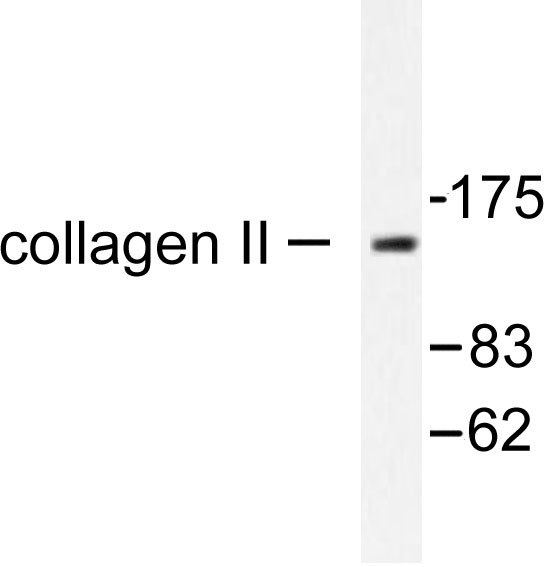 COL2A1 / Collagen II Alpha 1 Antibody - Western blot of Collagen II (P133) pAb in extracts from COLO205 cell.