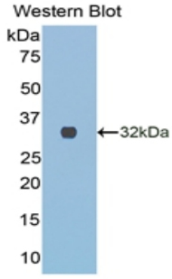 COL3A1 / Collagen III Antibody - Western blot of recombinant COL3A1 / Collagen III.  This image was taken for the unconjugated form of this product. Other forms have not been tested.
