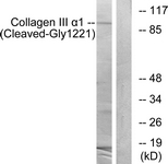 COL3A1 / Collagen III Antibody - Western blot of extracts from A549 cells, treated with etoposide 25 uM 24h, using Collagen III alpha1 (Cleaved-Gly1221) Antibody. The lane on the right is treated with the synthesized peptide.