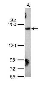 COL3A1 / Collagen III Antibody - Sample (30 ug of whole cell lysate). A: Hela. 5% SDS PAGE. COL3A1 antibody diluted at 1:1000.