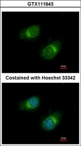 COL3A1 / Collagen III Antibody - Immunofluorescence of methanol-fixed HeLa using COL3A1 antibody at 1:50 dilution.