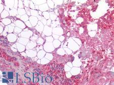 COL3A1 / Collagen III Antibody - Human Breast: Formalin-Fixed, Paraffin-Embedded (FFPE)
