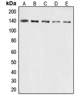 COL3A1 / Collagen III Antibody - Western blot analysis of Collagen 3 alpha 1 expression in A10 (A); HeLa (B); mouse lung (C); mouse liver (D); rat lung (E) whole cell lysates.