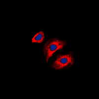 COL3A1 / Collagen III Antibody - Immunofluorescent analysis of Collagen 3 alpha 1 staining in HeLa cells. Formalin-fixed cells were permeabilized with 0.1% Triton X-100 in TBS for 5-10 minutes and blocked with 3% BSA-PBS for 30 minutes at room temperature. Cells were probed with the primary antibody in 3% BSA-PBS and incubated overnight at 4 C in a humidified chamber. Cells were washed with PBST and incubated with a DyLight 594-conjugated secondary antibody (red) in PBS at room temperature in the dark. DAPI was used to stain the cell nuclei (blue).