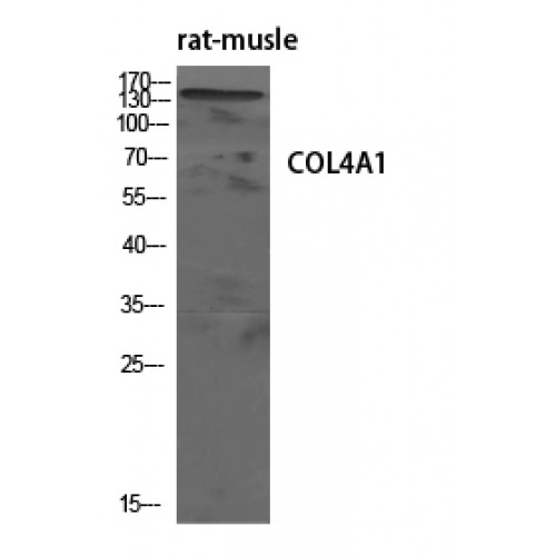 COL4A1 / Collagen IV Alpha1 Antibody - Western blot of COL4A1 antibody