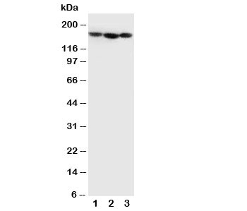 COL4A1 / Collagen IV Alpha1 Antibody - Western blot testing of Collagen IV antibody and Lane 1: MCF-7; 2: SCG; 3: SW620 cell lysate