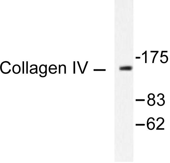 COL4A1 / Collagen IV Alpha1 Antibody - Western blot of Collagen IV (G46) pAb in extracts from HeLa cell.