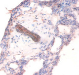 COL4A1 / Collagen IV Alpha1 Antibody - Immunohistochemistry of paraffin-embedded human lung tissue using COL4A1 Antibody at dilution of 1:100