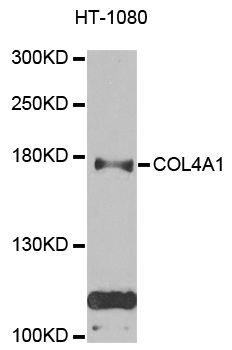 COL4A1 / Collagen IV Alpha1 Antibody - Western blot analysis of extracts of HT-1080 cells.
