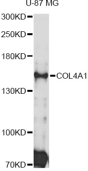 COL4A1 / Collagen IV Alpha1 Antibody - Western blot analysis of extracts of U-87 MG cells, using COL4A1 antibody at 1:3000 dilution. The secondary antibody used was an HRP Goat Anti-Rabbit IgG (H+L) at 1:10000 dilution. Lysates were loaded 25ug per lane and 3% nonfat dry milk in TBST was used for blocking. An ECL Kit was used for detection and the exposure time was 30s.