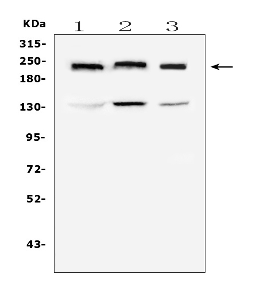 COL4A1 / Collagen IV Alpha1 Antibody - Western blot analysis of Collagen IV using anti-Collagen IV antibody. Electrophoresis was performed on a 8% SDS-PAGE gel at 70V (Stacking gel) / 90V (Resolving gel) for 2-3 hours. The sample well of each lane was loaded with 50ug of sample under reducing conditions. Lane 1: human HEK293T whole cell lysate, Lane 2: human Hela whole cell lysate, Lane 3: human A549 whole cell lysate. After Electrophoresis, proteins were transferred to a Nitrocellulose membrane at 150mA for 50-90 minutes. Blocked the membrane with 5% Non-fat Milk/ TBS for 1.5 hour at RT. The membrane was incubated with mouse anti-Collagen IV antigen affinity purified monoclonal antibody at 0.5 µg/mL overnight at 4°C, then washed with TBS-0.1% Tween 3 times with 5 minutes each and probed with a goat anti-mouse IgG-HRP secondary antibody at a dilution of 1:10000 for 1.5 hour at RT. The signal is developed using an Enhanced Chemiluminescent detection (ECL) kit with Tanon 5200 system. A specific band was detected for Collagen IV at approximately 220KD. The expected band size for Collagen IV is at 161KD.