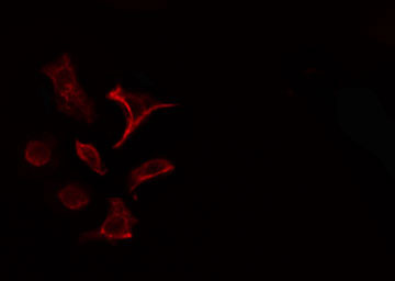 COL4A1 / Collagen IV Alpha1 Antibody - Staining HeLa cells by IF/ICC. The samples were fixed with PFA and permeabilized in 0.1% Triton X-100, then blocked in 10% serum for 45 min at 25°C. The primary antibody was diluted at 1:200 and incubated with the sample for 1 hour at 37°C. An Alexa Fluor 594 conjugated goat anti-rabbit IgG (H+L) antibody, diluted at 1/600, was used as secondary antibody.