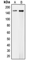 COL4A1 / Collagen IV Alpha1 Antibody - Western blot analysis of Collagen 4 alpha 1 expression in HEK293T (A); mouse endothelial (B) whole cell lysates.