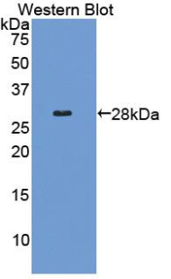 COL4A2 / Collagen IV Alpha2 Antibody - Western blot of recombinant COL4A2 / Collagen IV.