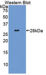 COL4A2 / Collagen IV Alpha2 Antibody - Western blot of recombinant COL4A2 / Collagen IV.