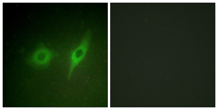 COL4A2 / Collagen IV Alpha2 Antibody - Immunofluorescence analysis of HeLa cells, using Collagen IV alpha2 Antibody. The picture on the right is blocked with the synthesized peptide.