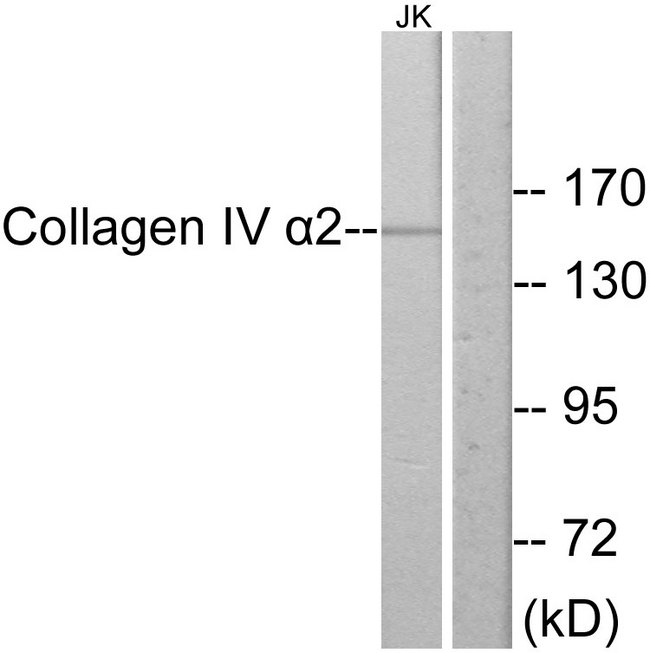 COL4A2 / Collagen IV Alpha2 Antibody - Western blot analysis of lysates from Jurkat cells, using Collagen IV alpha2 Antibody. The lane on the right is blocked with the synthesized peptide.