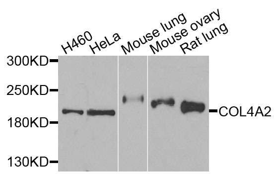 COL4A2 / Collagen IV Alpha2 Antibody - Western blot analysis of extracts of various cells.
