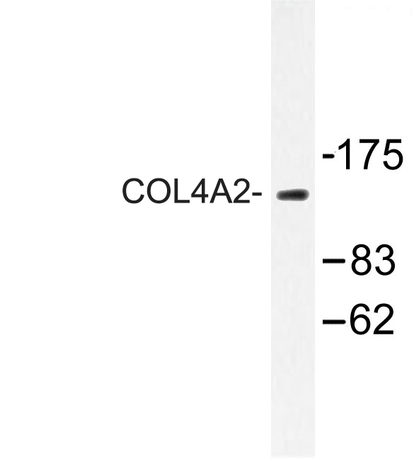 COL4A2 / Collagen IV Alpha2 Antibody - Western blot of COL4A2 (P175) pAb in extracts from Jurkat cells.