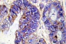 COL4A2 / Collagen IV Alpha2 Antibody - IHC of COL4A2 (P175) pAb in paraffin-embedded human colon carcinoma tissue.