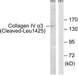 COL4A3 / Tumstatin Antibody - Western blot of extracts from 293 cells, treated with etoposide 25 uM 1h, using Collagen IV alpha3 (Cleaved-Leu1425) Antibody. The lane on the right is treated with the synthesized peptide.