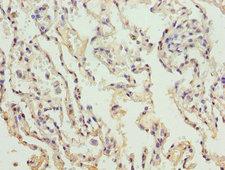 COL4A3 / Tumstatin Antibody - Immunohistochemistry of paraffin-embedded human placenta tissue using COL4A3 Antibody at dilution of 1:100