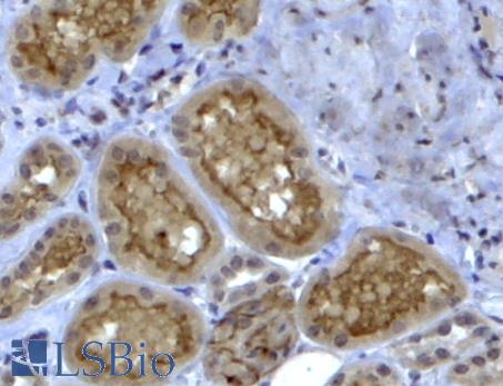COL4A3 / Tumstatin Antibody - COL4A3 antibody (4 ug/ml) staining of paraffin embedded Human Kidney. Steamed antigen retrieval with citrate buffer pH 6, HRP-staining.