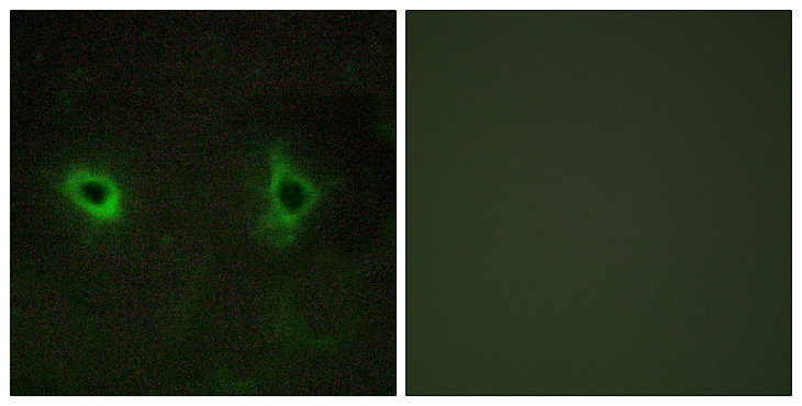 COL4A3 / Tumstatin Antibody - Immunofluorescence analysis of COS7 cells, using Collagen IV alpha3 Antibody. The picture on the right is blocked with the synthesized peptide.