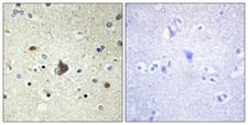 COL4A3 / Tumstatin Antibody - Immunohistochemistry analysis of paraffin-embedded human brain tissue, using Collagen IV alpha3 Antibody. The picture on the right is blocked with the synthesized peptide.