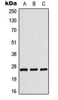 COL4A3 / Tumstatin Antibody - Western blot analysis of Tumstatin expression in HepG2 colchicine-treated (A); HeLa UV-treated (B); Raw264.7 colchicine-treated (C) whole cell lysates.