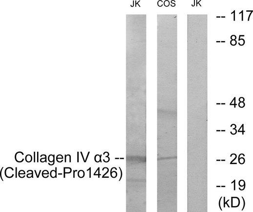 COL4A3 / Tumstatin Antibody - Western blot analysis of extracts from Jurkat cells treated with etoposide (25uM, 24hours) and COS-7 cells treated with etoposide (25uM, 1hour), using Collagen IV a3 (Cleaved-Pro1426) antibody.
