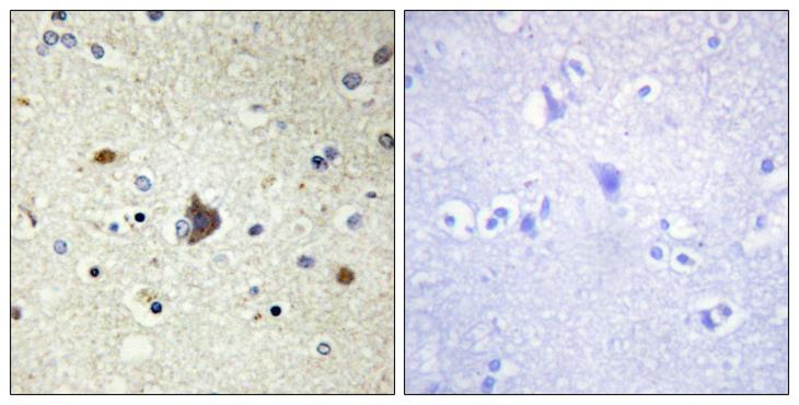COL4A3 / Tumstatin Antibody - Peptide - + Immunohistochemistry analysis of paraffin-embedded human brain tissue using Collagen IV a3 antibody.