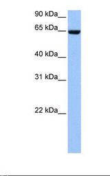 COL4A3BP / CERT Antibody - Hela cell lysate. Antibody concentration: 1.0 ug/ml. Gel concentration: 12%.  This image was taken for the unconjugated form of this product. Other forms have not been tested.