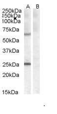 COL4A3BP / CERT Antibody - Goat Anti-COL4A3BP (aa662-672) Antibody (0.5µg/ml) staining of Mouse Heart lysate (A) + peptide (B) (35µg protein in RIPA buffer). Detected by chemiluminescencence.