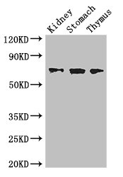 COL4A3BP / CERT Antibody - Western Blot Positive WB detected in: Mouse kidney tissue, Mouse stomach tissue, Mouse thymus tissue All lanes: COL4A3BP antibody at 3.4µg/ml Secondary Goat polyclonal to rabbit IgG at 1/50000 dilution Predicted band size: 71, 69, 84 kDa Observed band size: 71 kDa