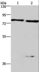 COL4A3BP / CERT Antibody - Western blot analysis of Mouse brain and kidney tissue, using COL4A3BP Polyclonal Antibody at dilution of 1:300.
