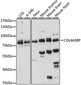 COL4A3BP / CERT Antibody - Western blot analysis of extracts of various cell lines, using COL4A3BP antibody at 1:1000 dilution. The secondary antibody used was an HRP Goat Anti-Rabbit IgG (H+L) at 1:10000 dilution. Lysates were loaded 25ug per lane and 3% nonfat dry milk in TBST was used for blocking. An ECL Kit was used for detection and the exposure time was 15s.
