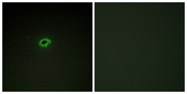 COL4A4 / Collagen IV Antibody - Immunofluorescence analysis of COS7 cells, using Collagen IV alpha4 Antibody. The picture on the right is blocked with the synthesized peptide.