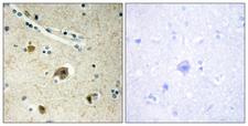 COL4A4 / Collagen IV Antibody - Immunohistochemistry analysis of paraffin-embedded human brain tissue, using Collagen IV alpha4 Antibody. The picture on the right is blocked with the synthesized peptide.