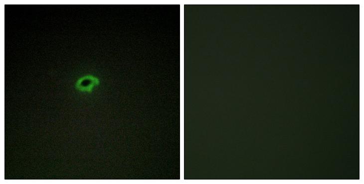 COL4A4 / Collagen IV Antibody - Peptide - + Immunofluorescence analysis of COS-7 cells, using Collagen IV a4 antibody.