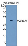 COL4A5 / Collagen IV Alpha5 Antibody - Western blot of recombinant COL4A5 / Collagen IV.
