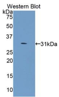 COL4A5 / Collagen IV Alpha5 Antibody - Western blot of recombinant COL4A5 / Collagen IV.  This image was taken for the unconjugated form of this product. Other forms have not been tested.