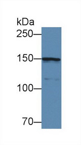COL4A5 / Collagen IV Alpha5 Antibody - Western Blot; Sample: Mouse Cerebrum lysate; Primary Ab: 3µg/ml Rabbit Anti-Human COL4a5 Antibody Second Ab: 0.2µg/mL HRP-Linked Caprine Anti-Rabbit IgG Polyclonal Antibody