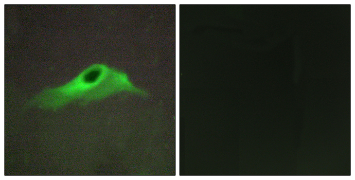COL4A5 / Collagen IV Alpha5 Antibody - Immunofluorescence analysis of HeLa cells, using Collagen IV alpha5 Antibody. The picture on the right is blocked with the synthesized peptide.