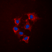 COL4A5 / Collagen IV Alpha5 Antibody - Immunofluorescent analysis of Collagen 4 alpha 5 staining in HeLa cells. Formalin-fixed cells were permeabilized with 0.1% Triton X-100 in TBS for 5-10 minutes and blocked with 3% BSA-PBS for 30 minutes at room temperature. Cells were probed with the primary antibody in 3% BSA-PBS and incubated overnight at 4 C in a humidified chamber. Cells were washed with PBST and incubated with a DyLight 594-conjugated secondary antibody (red) in PBS at room temperature in the dark. DAPI was used to stain the cell nuclei (blue).