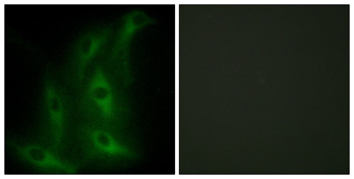 COL4A6 / Collagen IV Antibody - Immunofluorescence analysis of HeLa cells, using Collagen IV alpha6 Antibody. The picture on the right is blocked with the synthesized peptide.