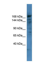 COL4A6 / Collagen IV Antibody - COL4A6 antibody Western blot of HT1080 cell lysate.  This image was taken for the unconjugated form of this product. Other forms have not been tested.