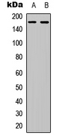 COL4A6 / Collagen IV Antibody - Western blot analysis of Collagen 4 alpha 6 expression in K562 (A); rat heart (B) whole cell lysates.